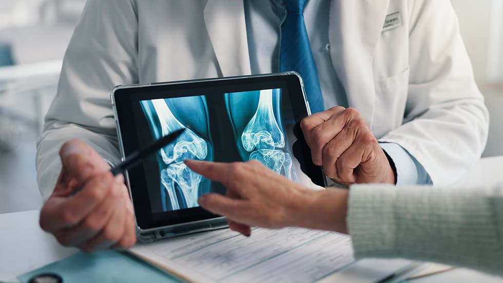Fratture nell’anziano: il ruolo della fisioterapia